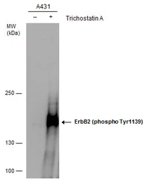 Anti-Her2 / ErbB2 (phospho Tyr1139) antibody used in Western Blot (WB). GTX130417